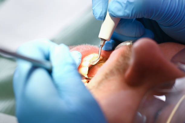 Best Urgent Care for Lost Fillings or Crowns in Danbury, CT