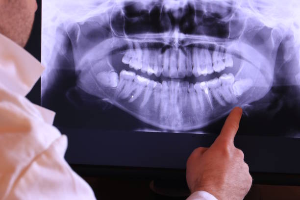 Best Emergency TMJ Treatment in Danbury, CT