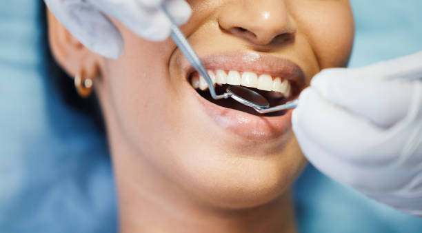 Best Emergency Tooth Extraction in Danbury, CT