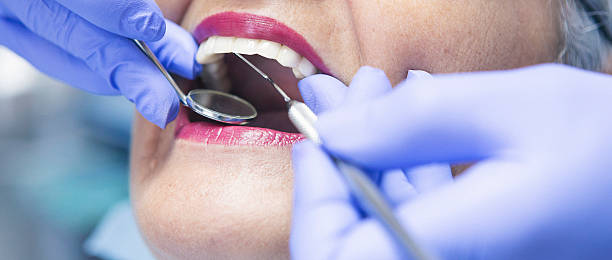 Best Emergency Gum Treatment in Danbury, CT